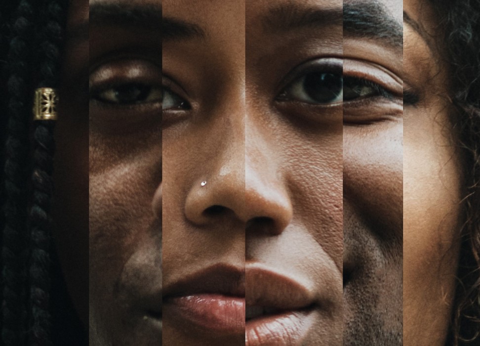 story-racism-discrimination-are-legacies-colonialism